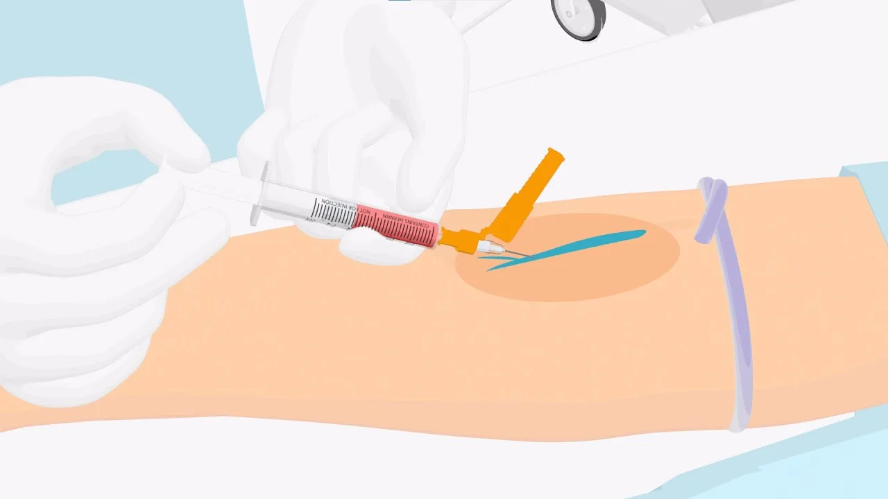 Arterial & Venous Blood Gas Interpretation