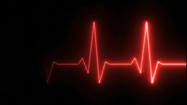 ECG Interpretation Masterclass