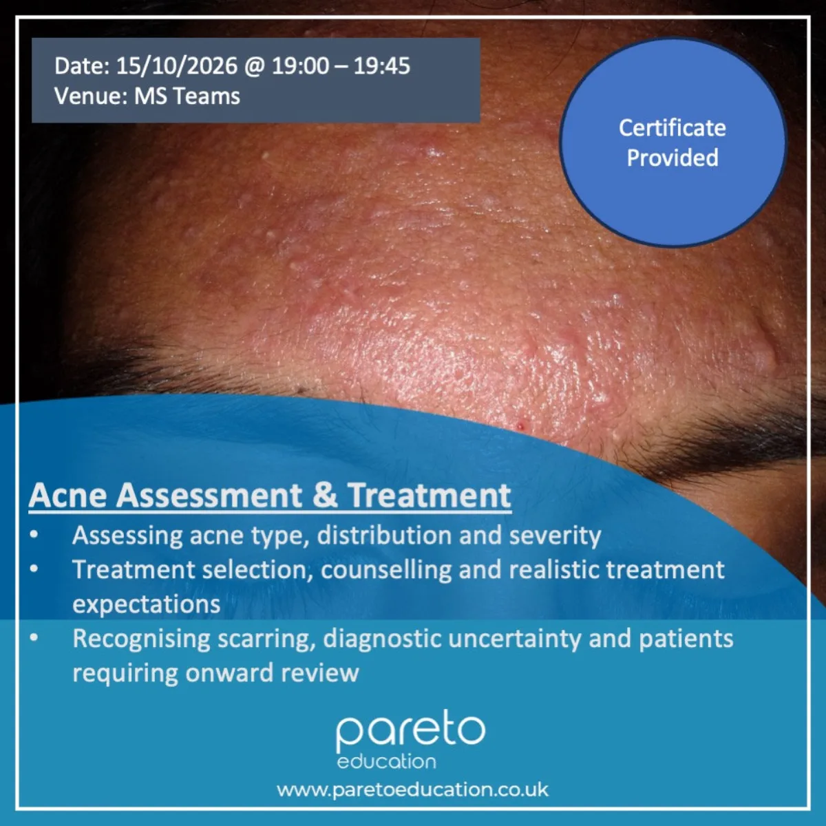 Acne Assessment & Treatment